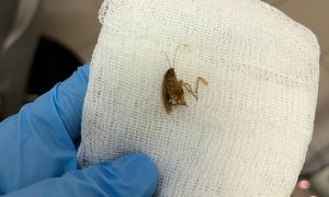 «В голове кто-то шевелится»: в Видном врачи удалили из уха женщины живого таракана