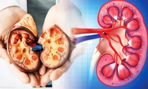 Почки умоляют о помощи, или Как распознать и лечить пиелонефрит