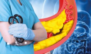 Причины повышения уровня холестерина: питание тут стоит на последнем месте