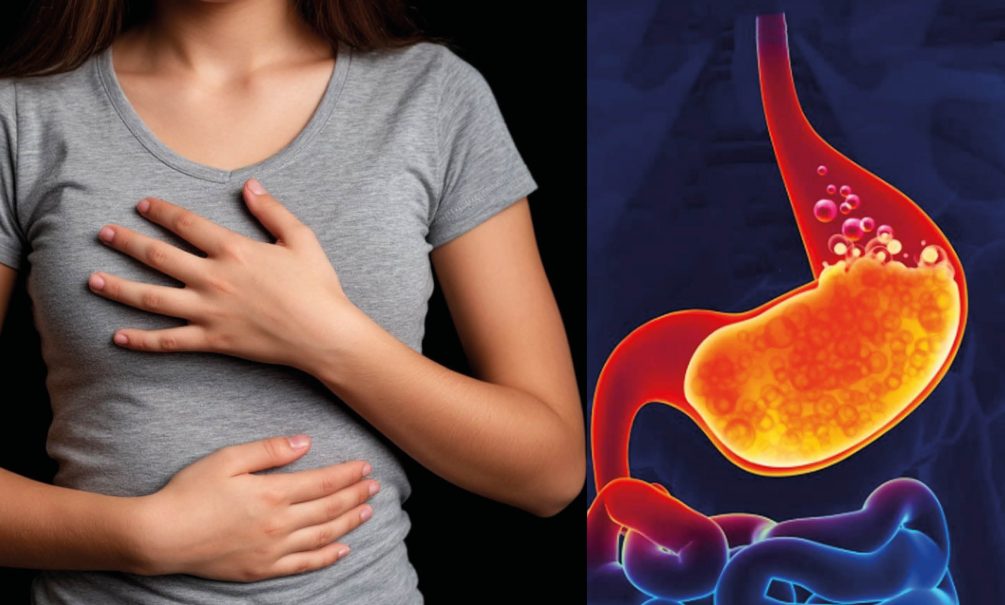 Замучил гастрит? Фастфуд и другая еда тут не причем 