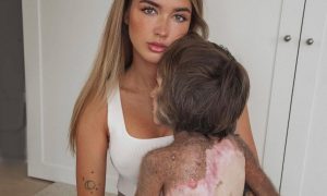 «Это меня травмировало»: Катя Мезенова, воспитывающая сына с гигантским невусом, расплакалась из-за травли