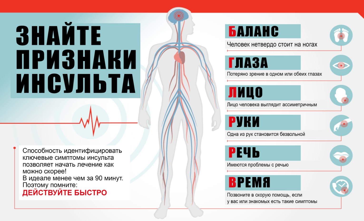 Пять признаков надвигающегося инсульта Блокнот.