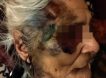 «Медпомощь оказывалась в полном объёме»: в ставропольской больнице забили 90-летнюю пенсионерку до полусмерти