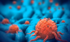Заразен ли рак, механизм образования злокачественной опухоли