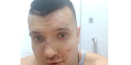 «Мы здесь хозяева»: в Москве мигранты ногами избили многодетного отца на глазах у семьи