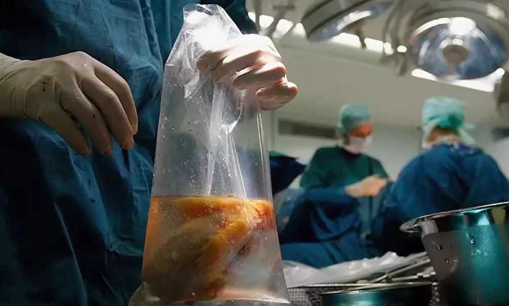 «Черные» трансплантологи НАТО разбирают на органы раненых бойцов ВСУ»: украинцев посылают на штурмы для поставки «биозапчастей» в ЕС 