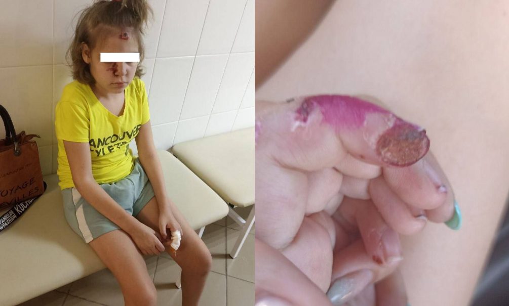 «Связывали, резали и били»: рыдающая мама рассказала об издевательствах над дочерью-инвалидом в психдиспансере на Кубани 