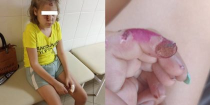 «Связывали, резали и били»: рыдающая мама рассказала об издевательствах над дочерью-инвалидом в психдиспансере на Кубани