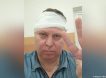 Ищут двух незнакомок: история с избиением депутата Госдумы в Самаре получила неожиданное продолжение