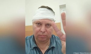 Ищут двух незнакомок: история с избиением депутата Госдумы в Самаре получила неожиданное продолжение