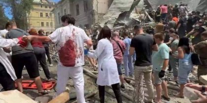 Фотографии окровавленного хирурга, после удара по киевской больнице Охматдет, оказались постановочными