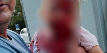 В Крыму родственница местного олигарха сбила на самокате трёхлетнюю девочку