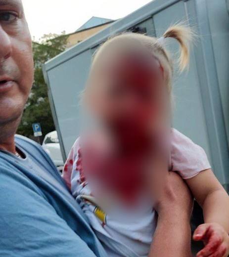 В Крыму родственница местного олигарха сбила на самокате трёхлетнюю девочку 