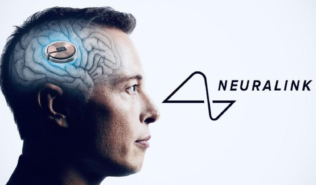 Илон Маск чипировал второго человека имплантом от Neuralink 