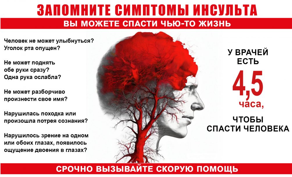 Пять грозных предвестников инсульта