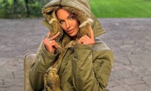 Анастасия Волочкова сделала себе «щечки молодости»: разбор пластического хирурга