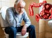«Колбаска» стала тоньше: этот и другие признаки рака толстой кишки
