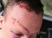 «Я тебя жду на подстанции, я тебя буду резать»: директор воронежского колледжа из ревности изрезал сопернику лицо