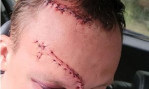 «Я тебя жду на подстанции, я тебя буду резать»: директор воронежского колледжа из ревности изрезал сопернику лицо