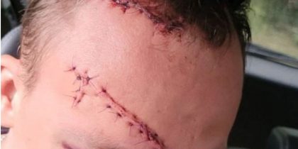«Я тебя жду на подстанции, я тебя буду резать»: директор воронежского колледжа из ревности изрезал сопернику лицо «Я тебя жду на подстанции, я тебя буду резать»: директор воронежского колледжа из ревности изрезал сопернику лицо