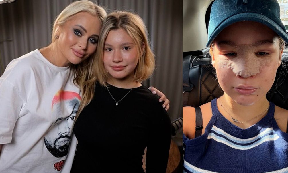 Дана Борисова «подарила» несовершеннолетней дочери пластику груди и откачку жира из «проблемных зон» 