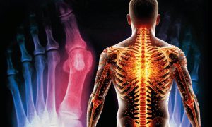 Эта маленькая косточка превратит позвоночник в труху