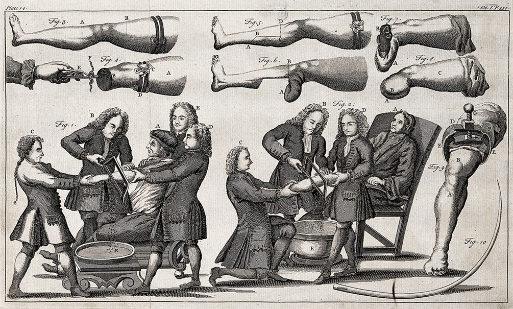 Раненых солдат ВСУ косит гангрена: все хуже, чем в Первую и Вторую мировые Раненых солдат ВСУ косит гангрена: все хуже, чем в Первую и Вторую мировые