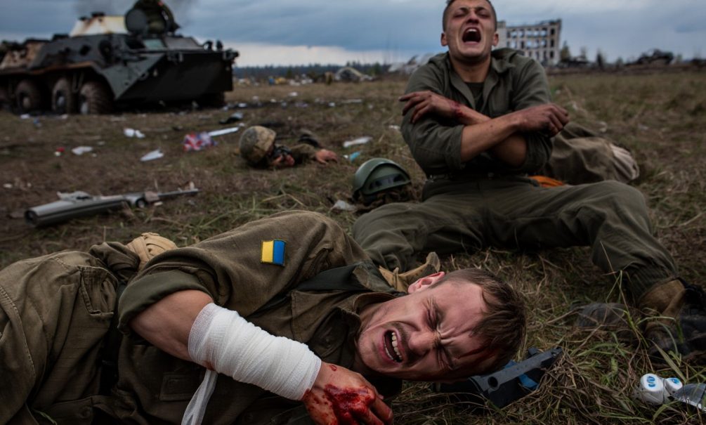 Военные ВСУ массово лишаются конечностей из-за медицинских стандартов НАТО