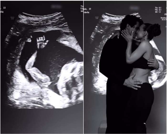 У беременной Лерчек возникли проблемы со здоровьем: «Ситуация сложная»