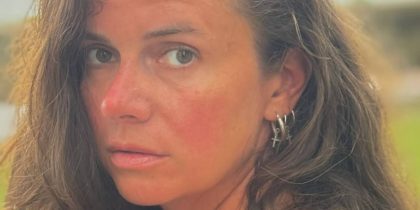 Ударили ложкой для обуви, вырвали волосы и укусили: звезду сериала «СашаТаня» избили в московском фитнес-клубе