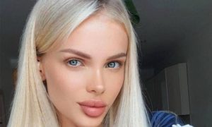 Лишившаяся части головы модель Анжелика Тартанова помирилась с бывшим-истязателем