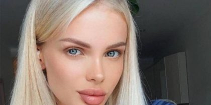 Лишившаяся части головы модель Анжелика Тартанова помирилась с бывшим-истязателем