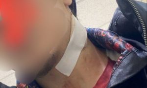 В Дагестане пьяный охранник школы ударил ножом 16-летнего подростка за игру в снежки