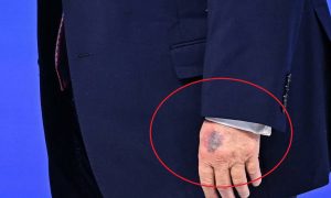 Трампу осталось недолго: на руках президента США снова появились жуткие синяки