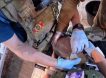 Подвиг военврачей: в зоне СВО хирурги в бронежилетах провели уникальную операцию