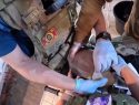 Подвиг военврачей: в зоне СВО хирурги в бронежилетах провели уникальную операцию