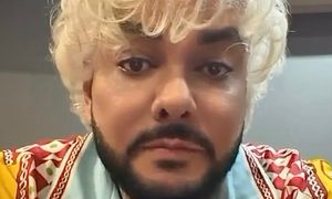 «Не от хорошей жизни»: Филипп Киркоров рассказал, зачем делает пластические операции