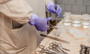 Москвич проснулся после дня рождения с закрученной гайкой на пенисе – ему грозила ампутация органа