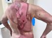 Муж насильник-рецидивист облил кипятком бывшую жену в Подмосковье из-за квартиры и телефона